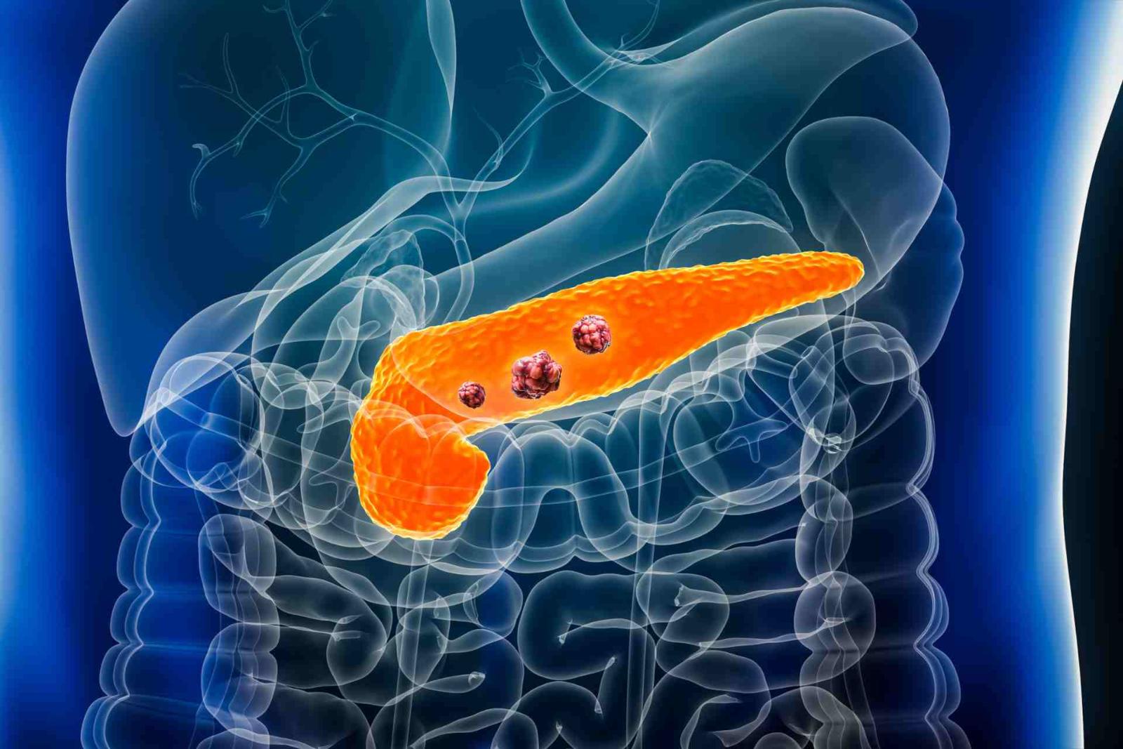 'Spring school of pancreas', il 19 e 20 giugno Ascoli accoglie i massimi esperti in gastroenterologia 